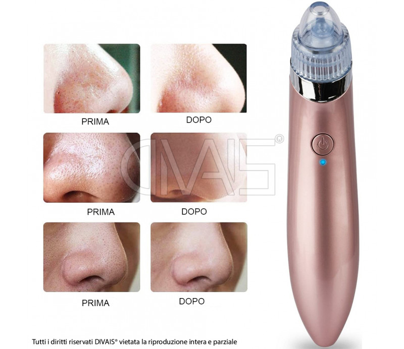 Aspiratore facciale portatile